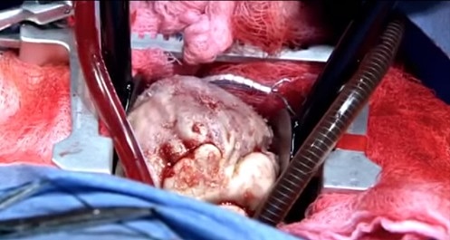 Sale con éxito la separación de los siameses