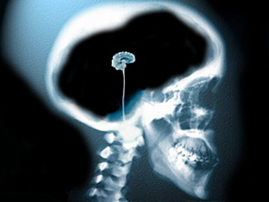 En el siglo XX se Polarizó los Rayos X