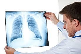 BASES DE LA RADIOLOGÍA