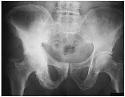 RAYOS X DEL SISTEMA ÓSEO