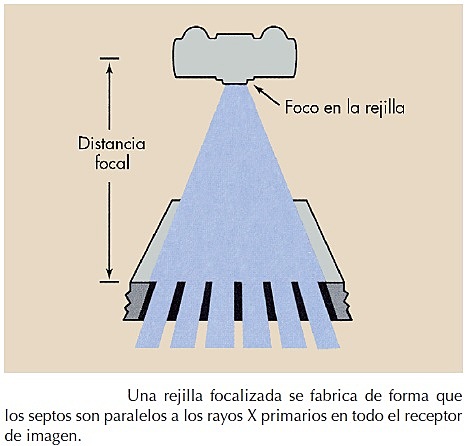 REJILLA ANTIDIFUSORA