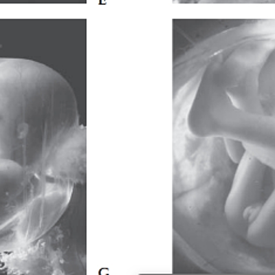 Timeline: DESARROLLO PRENATAL