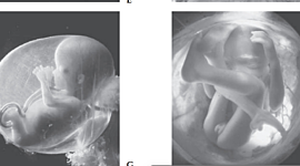 Timeline: DESARROLLO PRENATAL