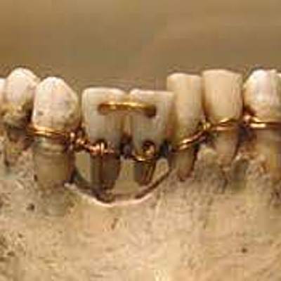 Timeline: Historia de la Odontología