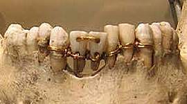 Timeline: Historia de la Odontología