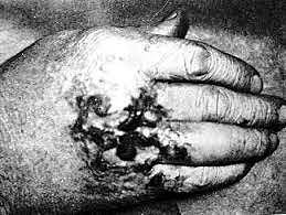 Efectos de la Radiación.