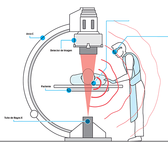 Limites de tiempo en la absorción radiológica