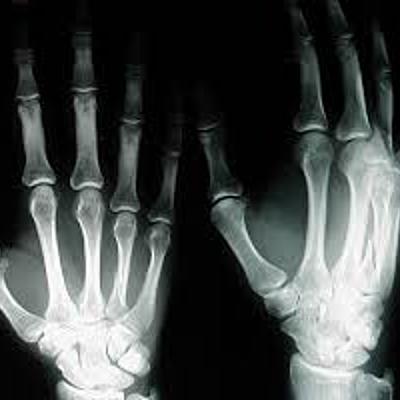 Timeline: Historia de los rayos X