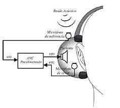 Albert Einstein y sus Audífono Alectroacústico
