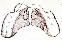 Aparato de expansión