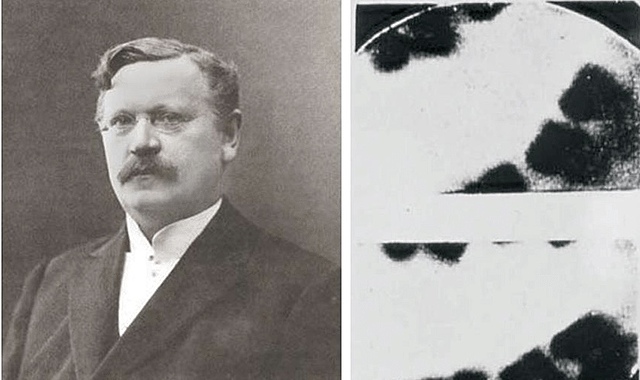 Se efectúa la primera radiografía