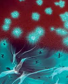 LA TEORÍA DEL MIASMA