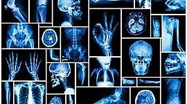 Timeline: Historia de la Radiología