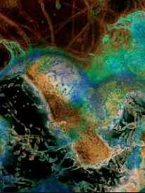 LA TEORÍA MICROBIANA