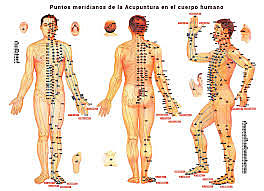 Acupultura  China 100 A.C
