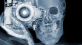 Timeline: Protección Radiología