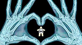 Timeline: Historia de la Radiología.