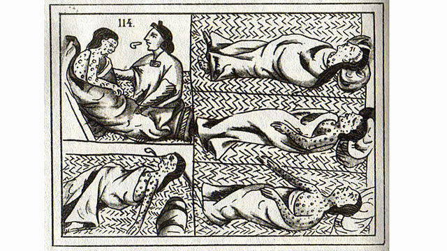 La enfermedad de la Viruela