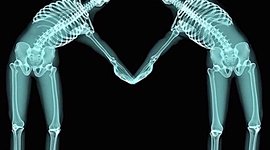 Timeline: Historia de la radiologia