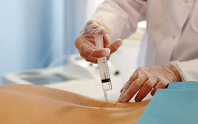 Ozonoterapia - Weningy y Albergs