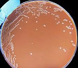 Secuenciación genoma Haemophilus influenzae