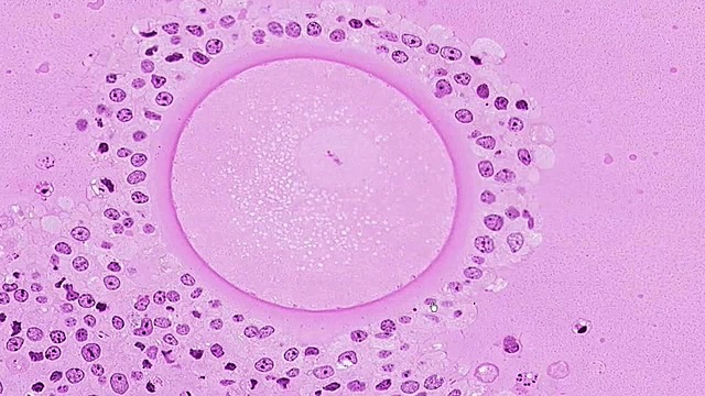 Regnier de Graaf (1641/1673)