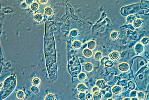 Teoría Microbiana sin Pasteur y Koch