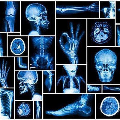 Timeline: Historia de la Radiologia