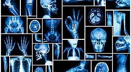 Timeline: Historia de la Radiologia