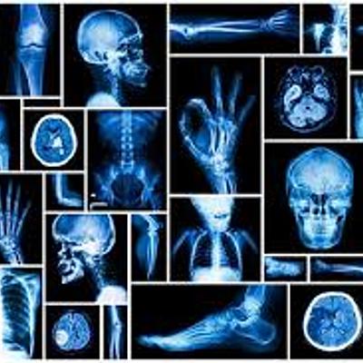 Timeline: Historia de la Radiología