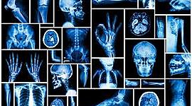 Timeline: Historia de la Radiología