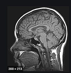 Resonancia Magnetica Nuclear