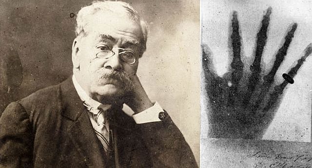 Primer aparato de rayos X