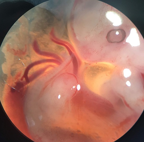 Theodor Ludwig y Rudolph Albert von K'ker