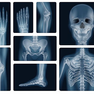 Timeline: Historia de los Rayos X