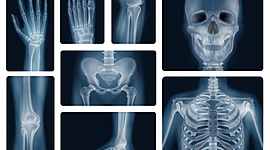 Timeline: Historia de los Rayos X