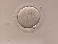 Theodor Ludwing Wilhelm Bischoff (1807-1882)