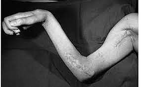 Primera Guerra Mundial