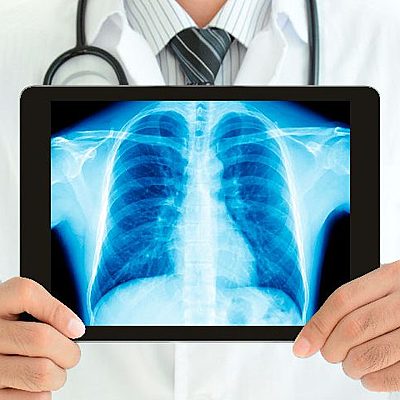 Timeline: Radiologia