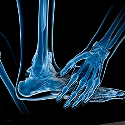 Timeline: HISTORIA DE TRAUMATOLOGIA Y ORTOPEDIA