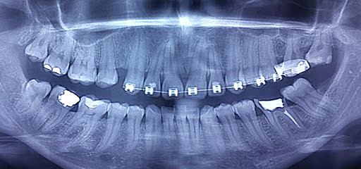 Radiología oral y maxilofacial