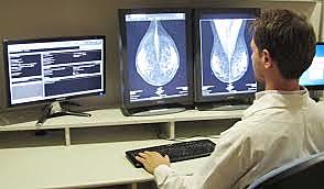 Imagen mamografíca