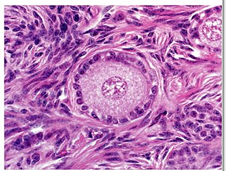 Ovocito primario 46,xx