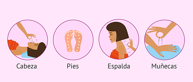 Medicina Tradicional China (Incluye Acupuntura)