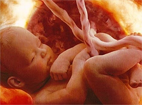 OCTAVO MES DEL DESARROLLO FETAL