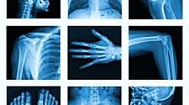 Timeline: linea del tiempo radiobiologia y radioproteccion