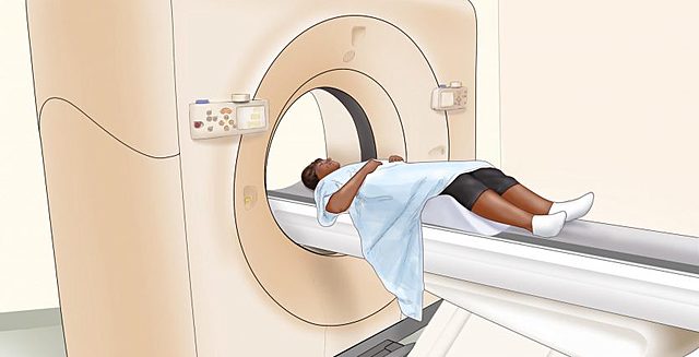 La tomografía computarizada