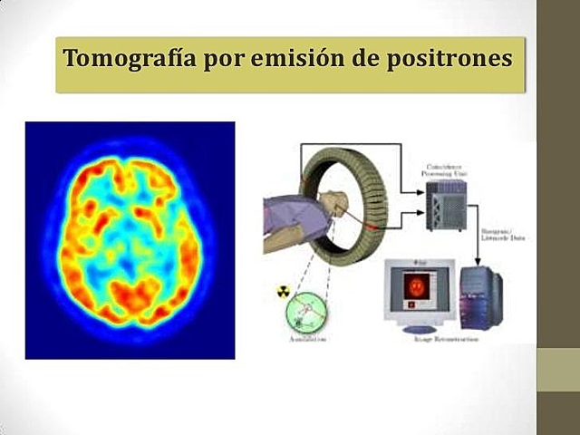 La tomografía por emisión de positrones