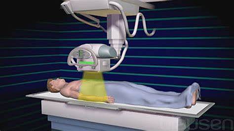 Tratamiento éxito del Cáncer con rayos X
