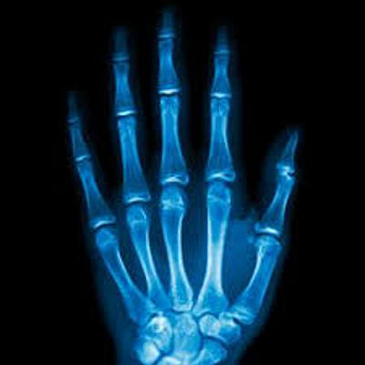 Timeline: Historia de la radiología